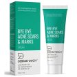 Dermatouch Bye Bye Acne Scars & Marks Cream Online Hot Sale